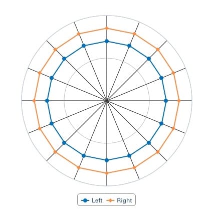 A perfectly tensioned wheel